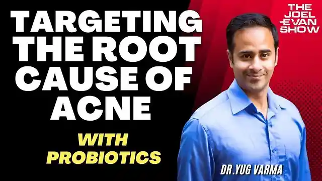 Targeting the Root Cause of Acne with Probiotics - Dr. Yug Varma [Phyla Biotics]